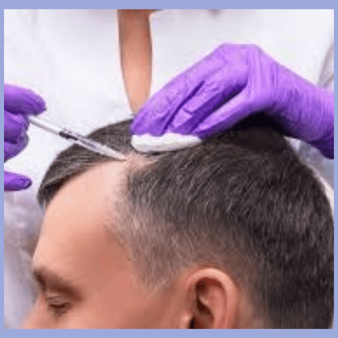 Mezoterapia vlasov