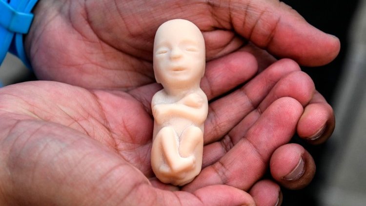 Pár myšlienok o umelých potratoch