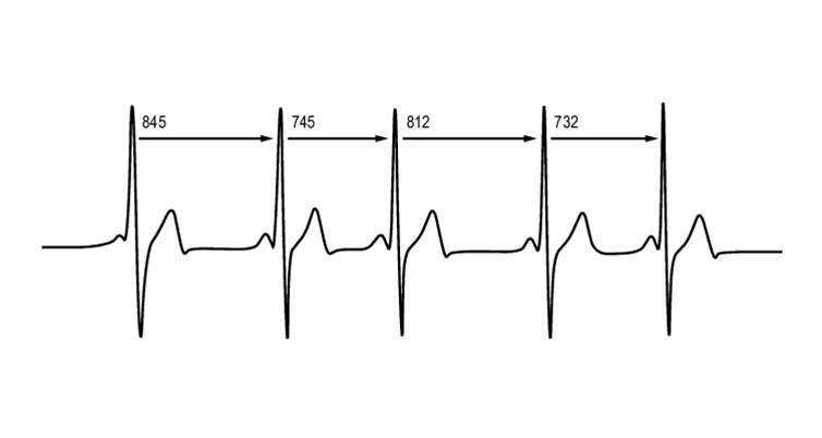 MySasy - variabilita srdeční frekvence, jako prvek sledování tréninku